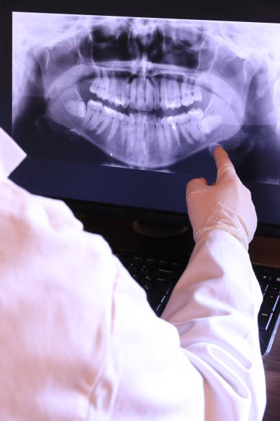 Best Knocked-Out Tooth (Avulsed Tooth) Treatment in Carnation, WA